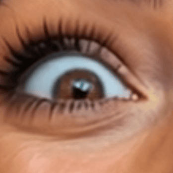A close-up of a wide open brown eye with long eyelashes and visible skin texture around it.